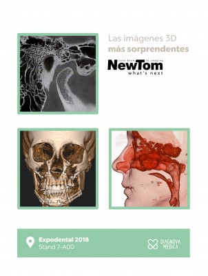 DIAGNOVA MEDICA EN EXPODENTAL 2018